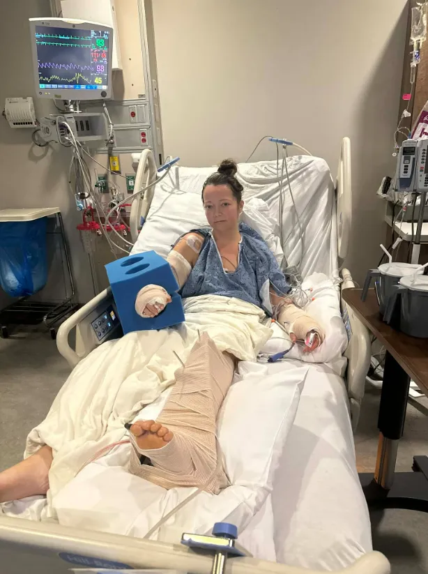 Brutális kutyatámadás áldozata lett az édesanya