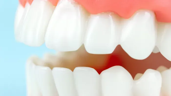 Túl sokáig szedte a gyógyszert, kihullottak a fogai