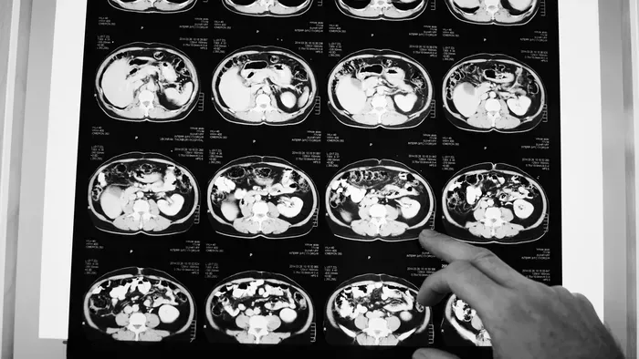 6 nappal a halála előtt zavarták haza az orvosok a rákos nőt