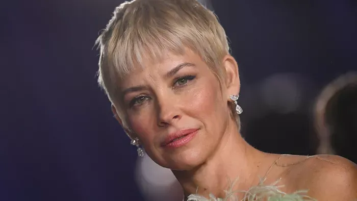 Agykárosodást szenvedett a Marvel-filmek sztárja