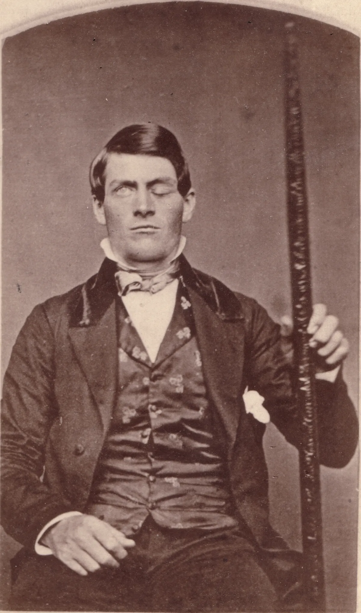 Phineas Gage fotója, kezében a vasrúddal, amely az agysérülést okozta.
