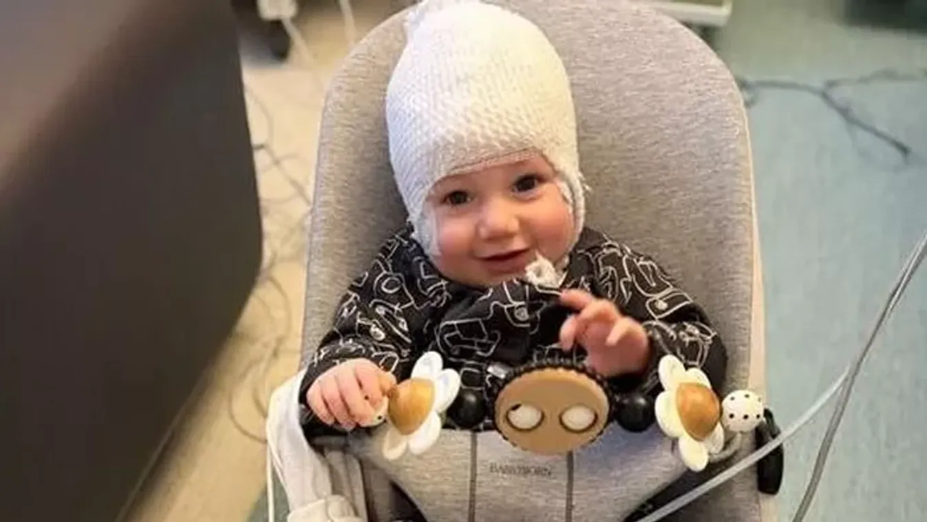 Csecsemőjük szemén látták, hogy valami nincs rendben – lesújtó diagnózist kapott a kisfiú