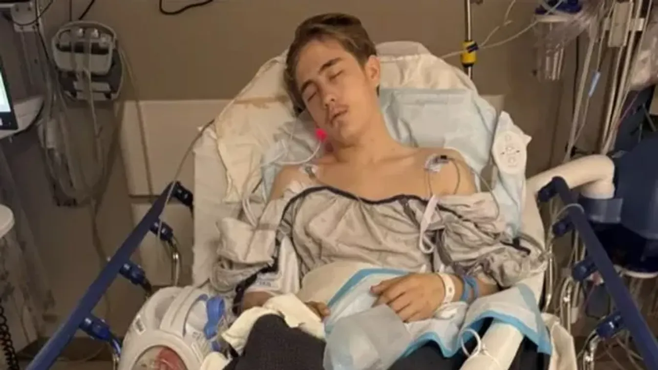 Csak segíteni akart, elgázolták a 16 éves fiút –&nbsp;„Nagyon hosszú út áll még előttünk”