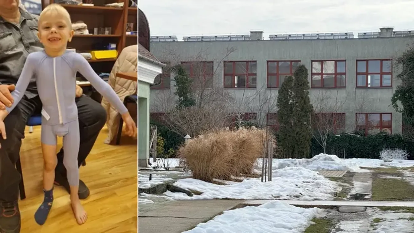 Stadler József családjának üzent a két évvel ezelőtt megégett Ricsike édesanyja