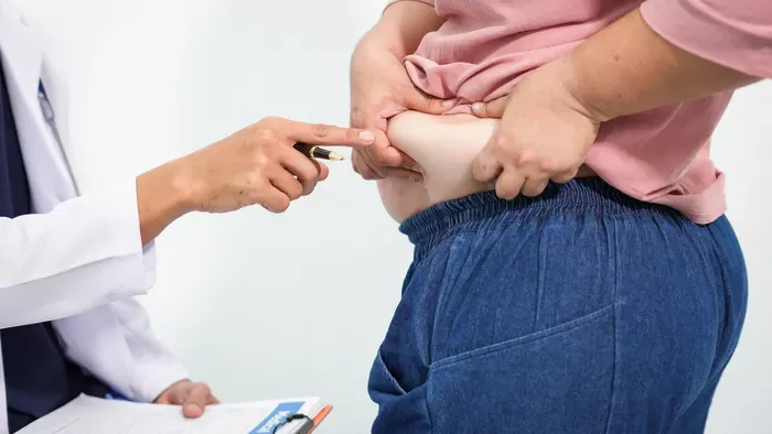 Cushing-szindróma: jelek, hogy a stresszhormon túltermelődik