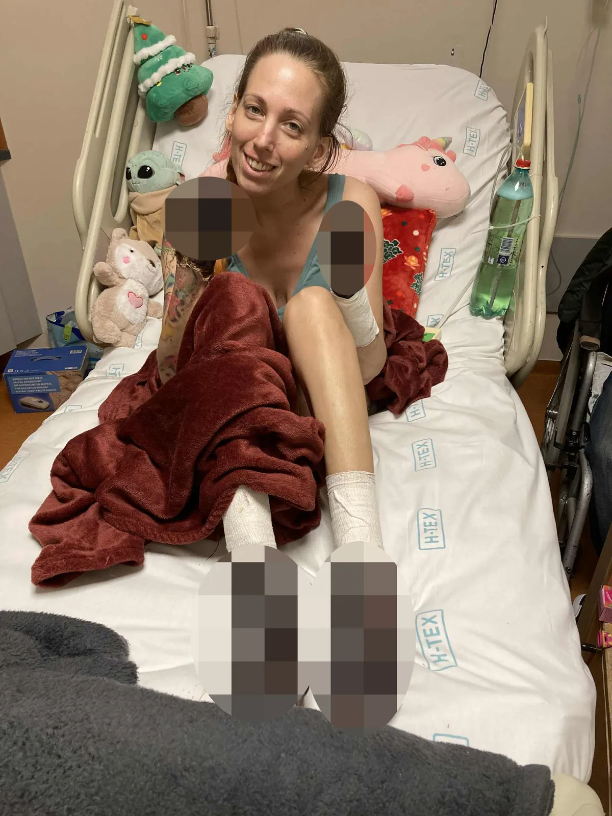 Fanni végtagjait amputálni kell és még így is  mosolyog  