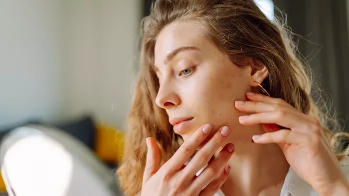 Pattanás ellen: mit egyél, és mit kerülj el?