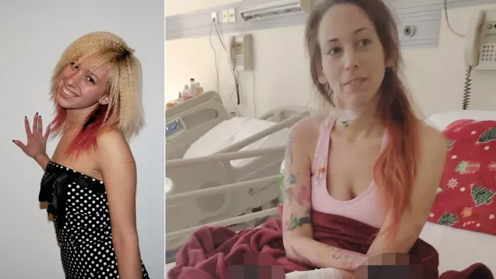 Fanni végtagjait amputálni kellett egy rutinműtét után