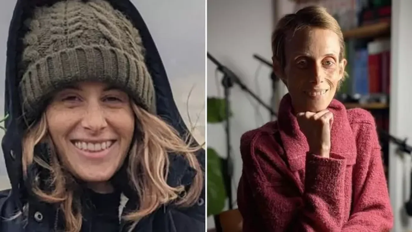 "Mintha gyorsított felvételen öregedett volna" – leleplezte a gyászoló férj, milyen valójában a rák elleni küzdelem