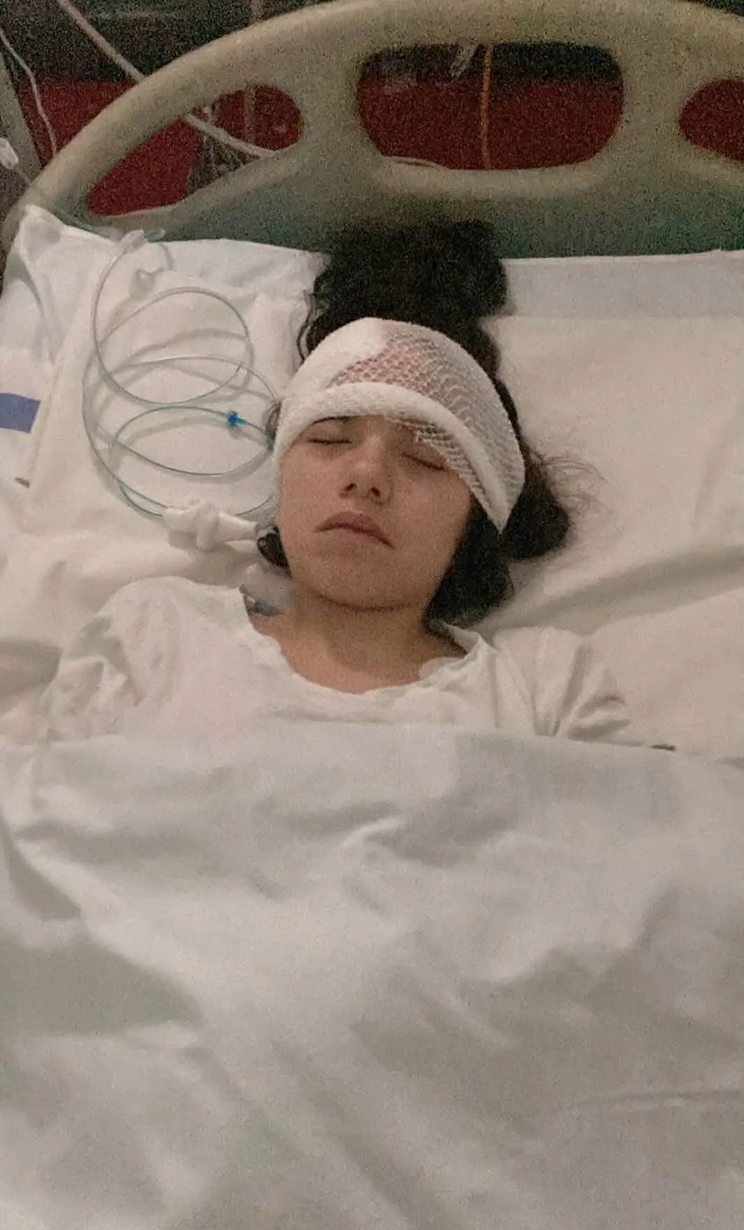 Annának 4 órás agyműtétje volt