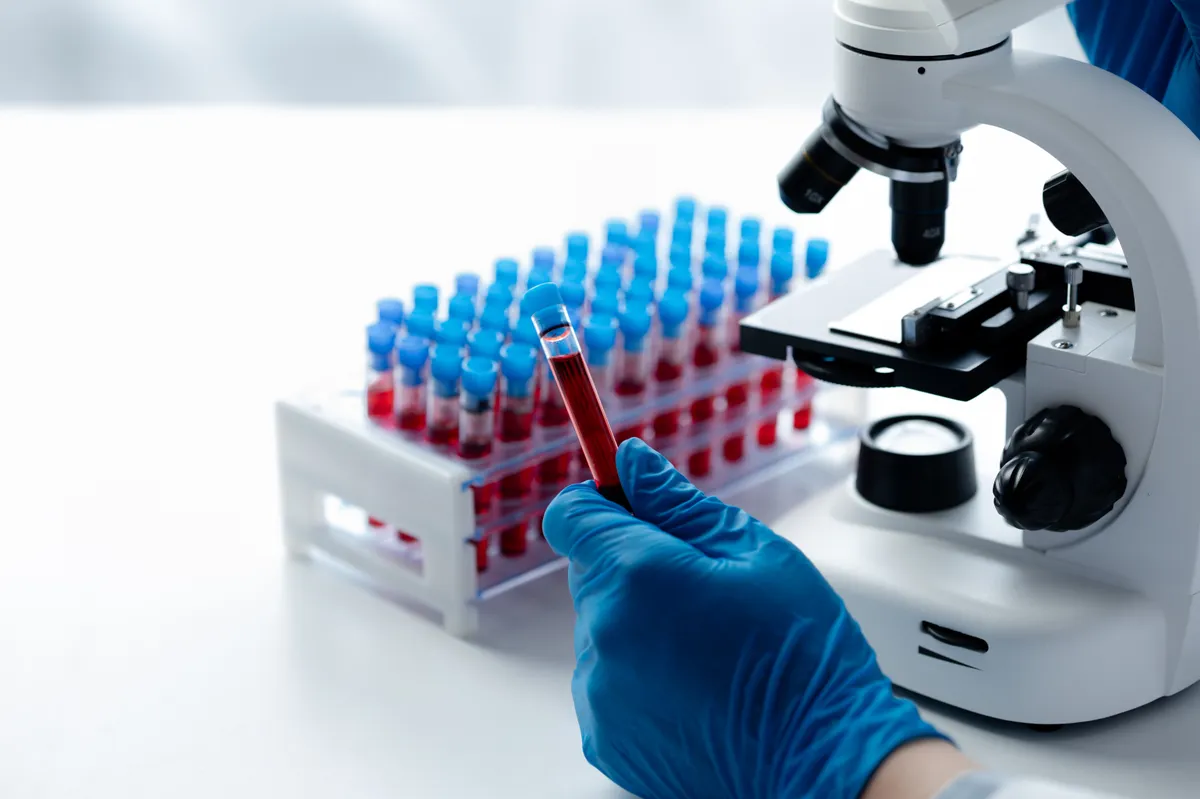 vérvizsgálatot végző orvos