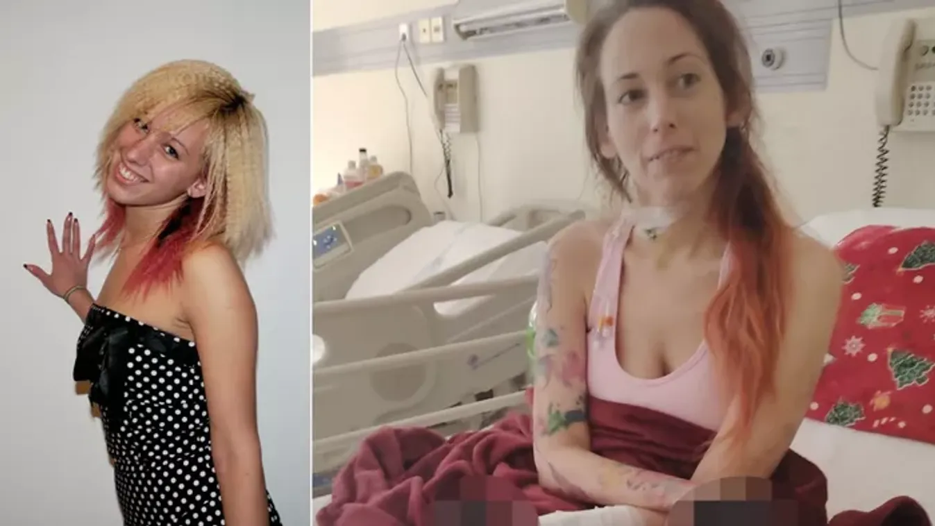 Rutinműtétre ment a gyönyörű fodrászlány, mind a négy végtagját amputálni kellett