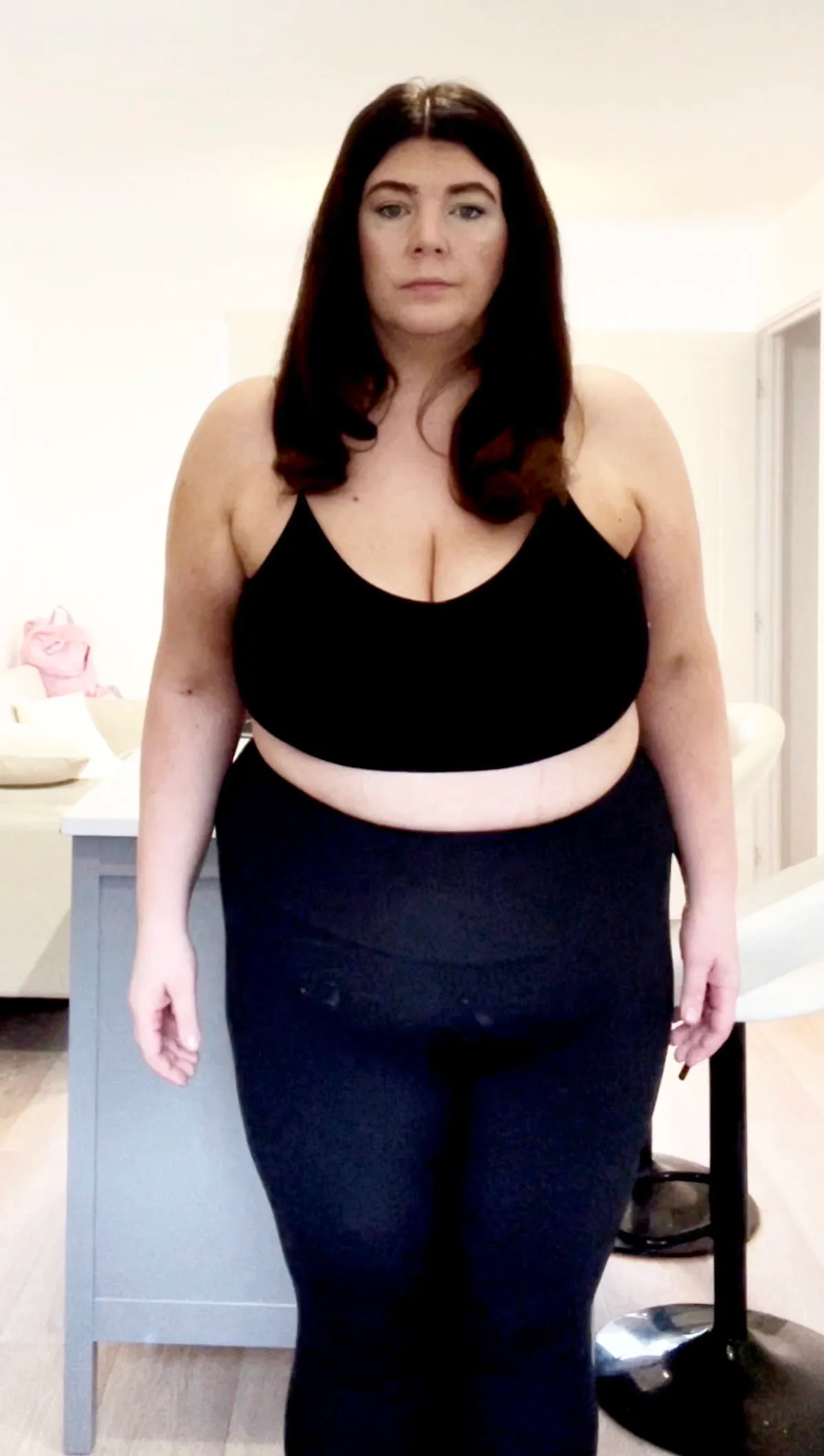 Fogyasztószer miatt távolították el az anyuka epehólyagját