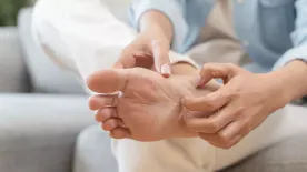 Ne vedd félvállról a szakértő figyelmeztetését: súlyos betegséget is jelezhet, ha így néz ki a talpad