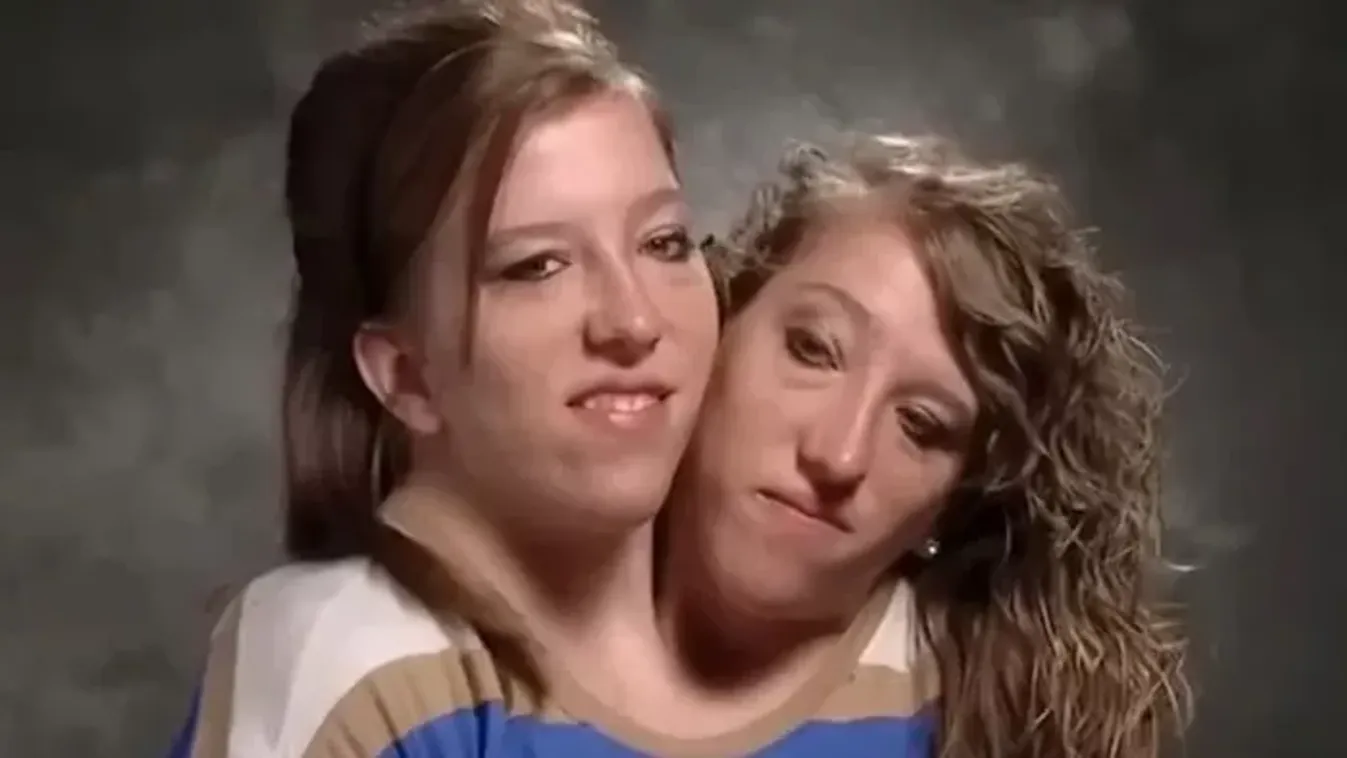 „Sziámi ikrek vagyunk, és közös a vaginánk, így működik a szexuális életünk”