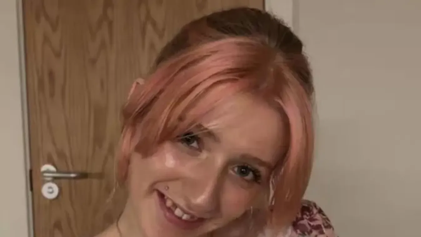 "Azt hiszik, drogfüggő vagyok, mert esnek ki a fogaim, de valójába krónikus beteg vagyok"