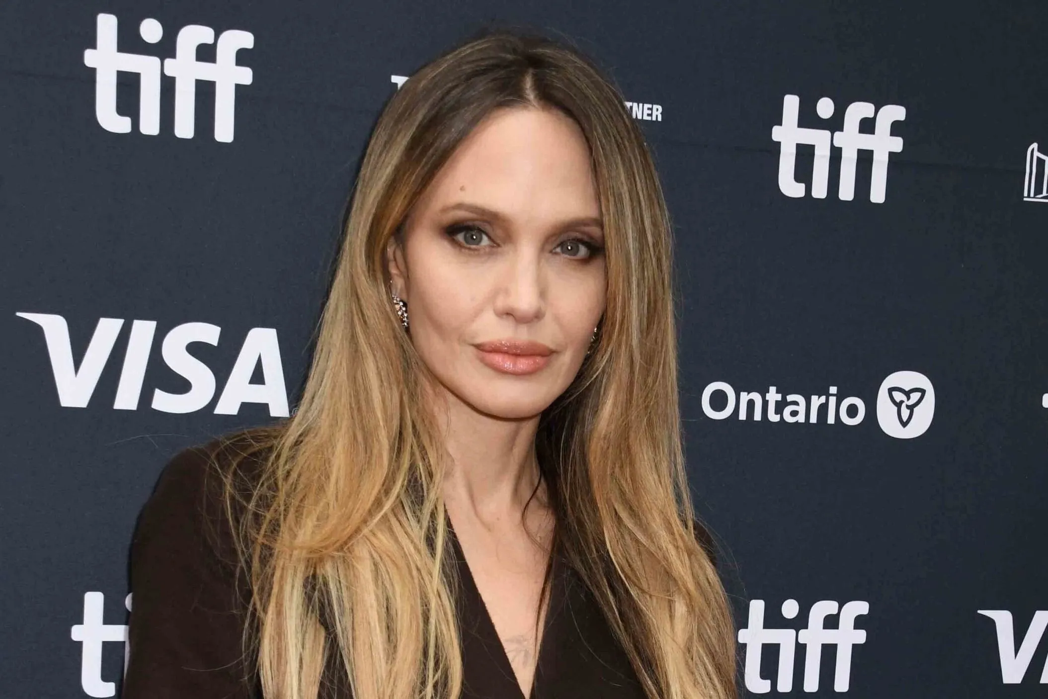 Megszólalt a hegeiről Angelina Jolie: "Egy döntés eredményei"