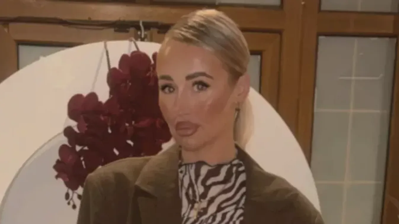 Ritka betegséggel diagnosztizálták a nőt: a házat sem hagyhatja el, ha hideg van vagy fúj a szél