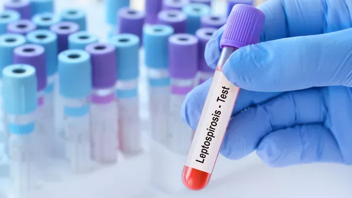 Lepra – Így él ma velünk a milliókat érintő kór