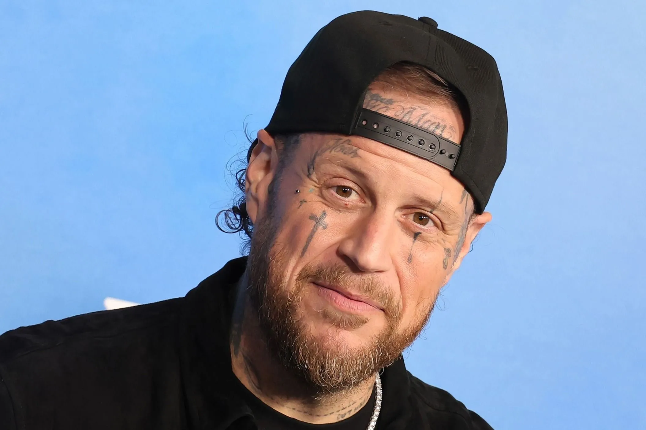 Jelly Roll kórházba került, súlyos balesetet szenvedett