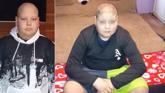 Patrik 13 évesen vív küzdelmet a daganattal