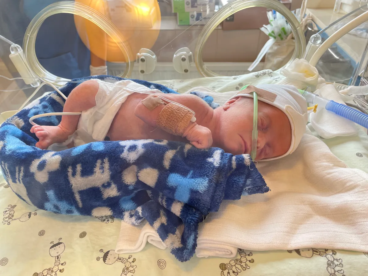 Mexikói kezelés segíthet Beninek: születésekor derült ki, hogy több agyvérzése is volt magzati korban