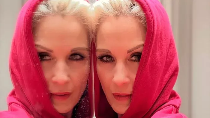 Orosz Barbara kifakadt a plasztikai beavatkozásokról