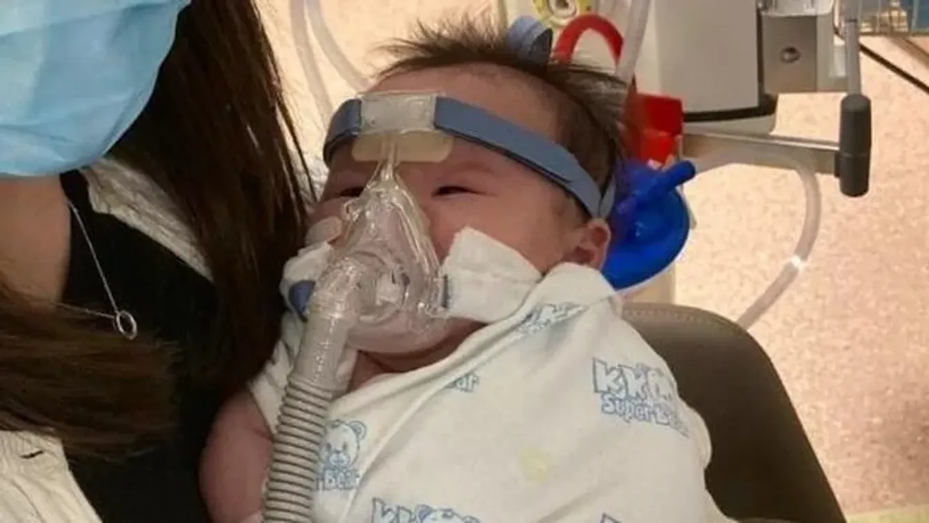 Ritka, halálos betegséggel született a tündéri kisbaba – aztán valóságos csoda történt