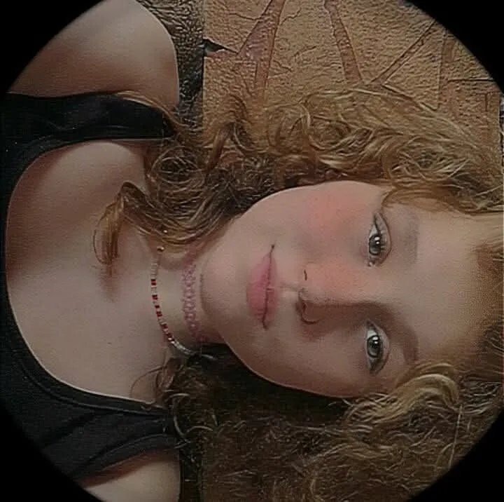 Eliza lelkileg nehezen viselte, hogy kihullott a gyönyörű haja