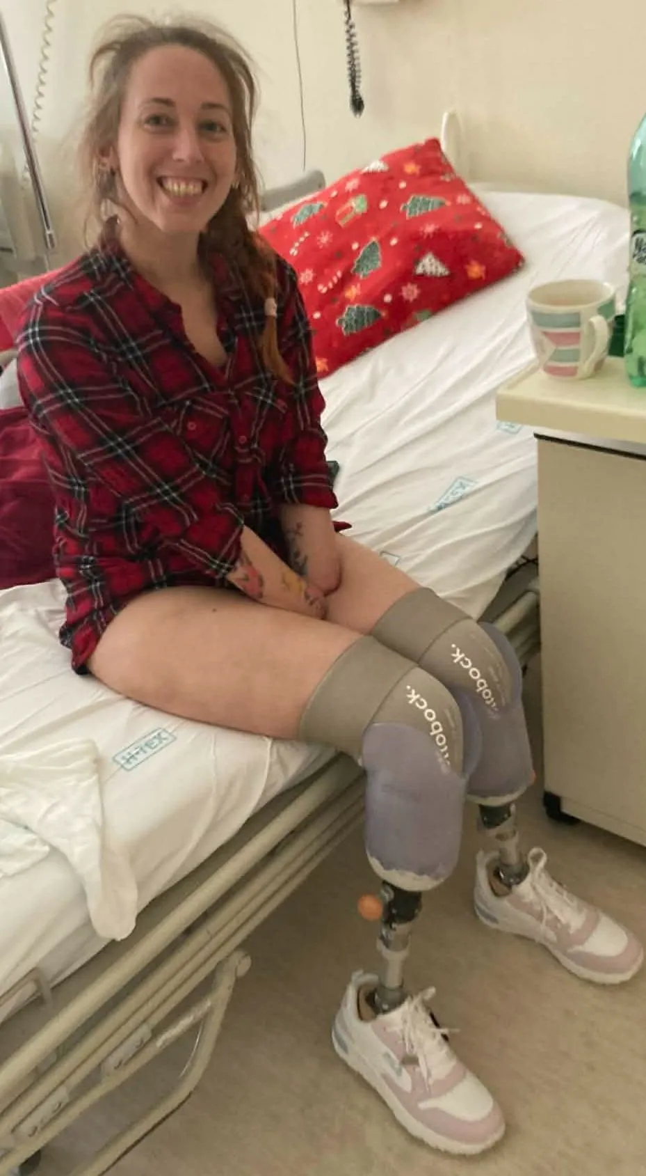 Amputáció után: Fanni nagyon boldog, hogy végre megkapta a műlábait