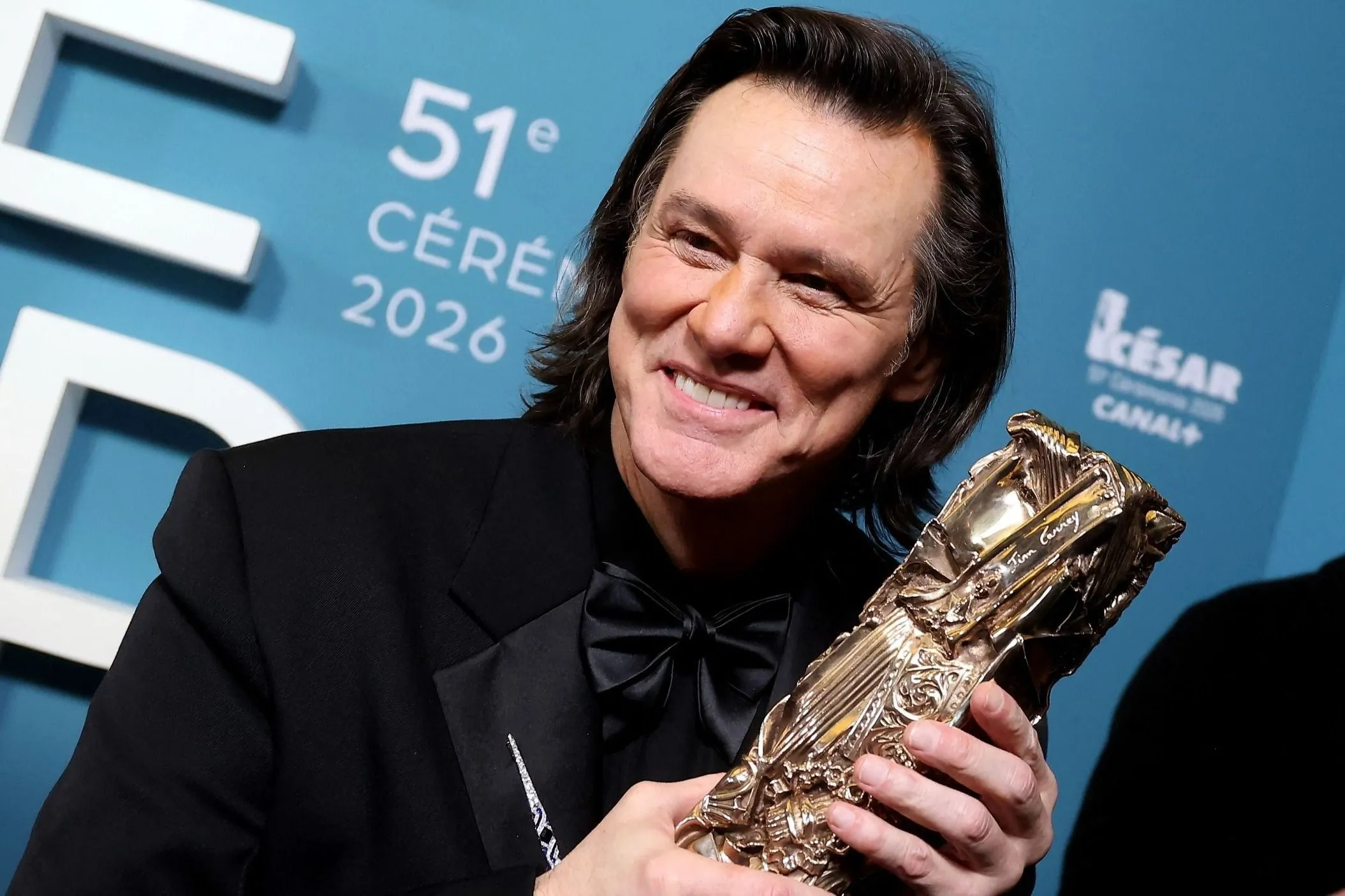 Jim Carrey védelmére kelt a világhírű plasztikai sebész