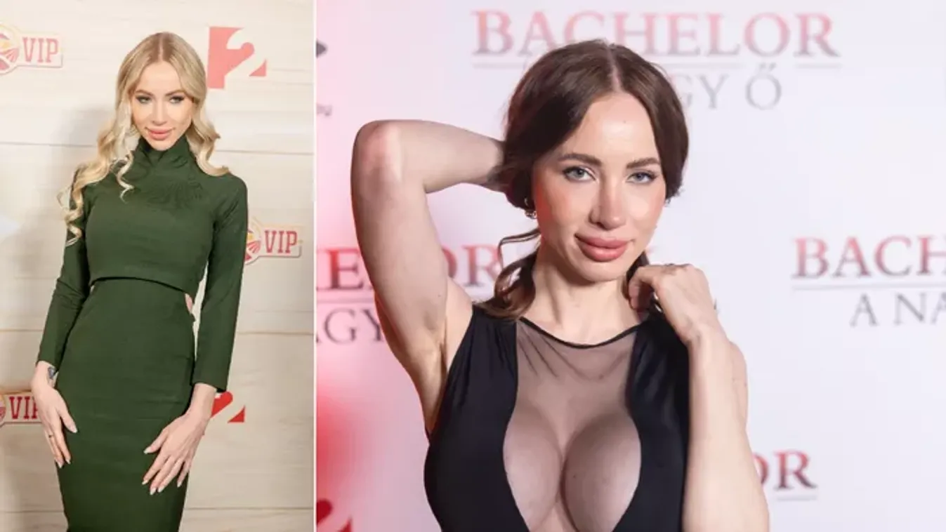 Újabb orrműtétre készül Kiara Lord: „Szedjenek ki maximálisan annyi szövetet, amennyit lehet”