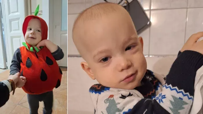 Születése óta agydaganattal harcol a kétéves Bertold