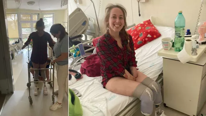 Amputáció után: Fanni végre megkapta a műlábait