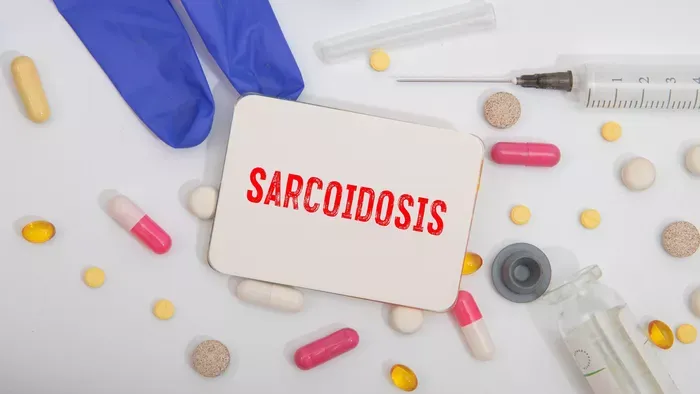 Szarkoidózis - Főként a tüdőt érinti