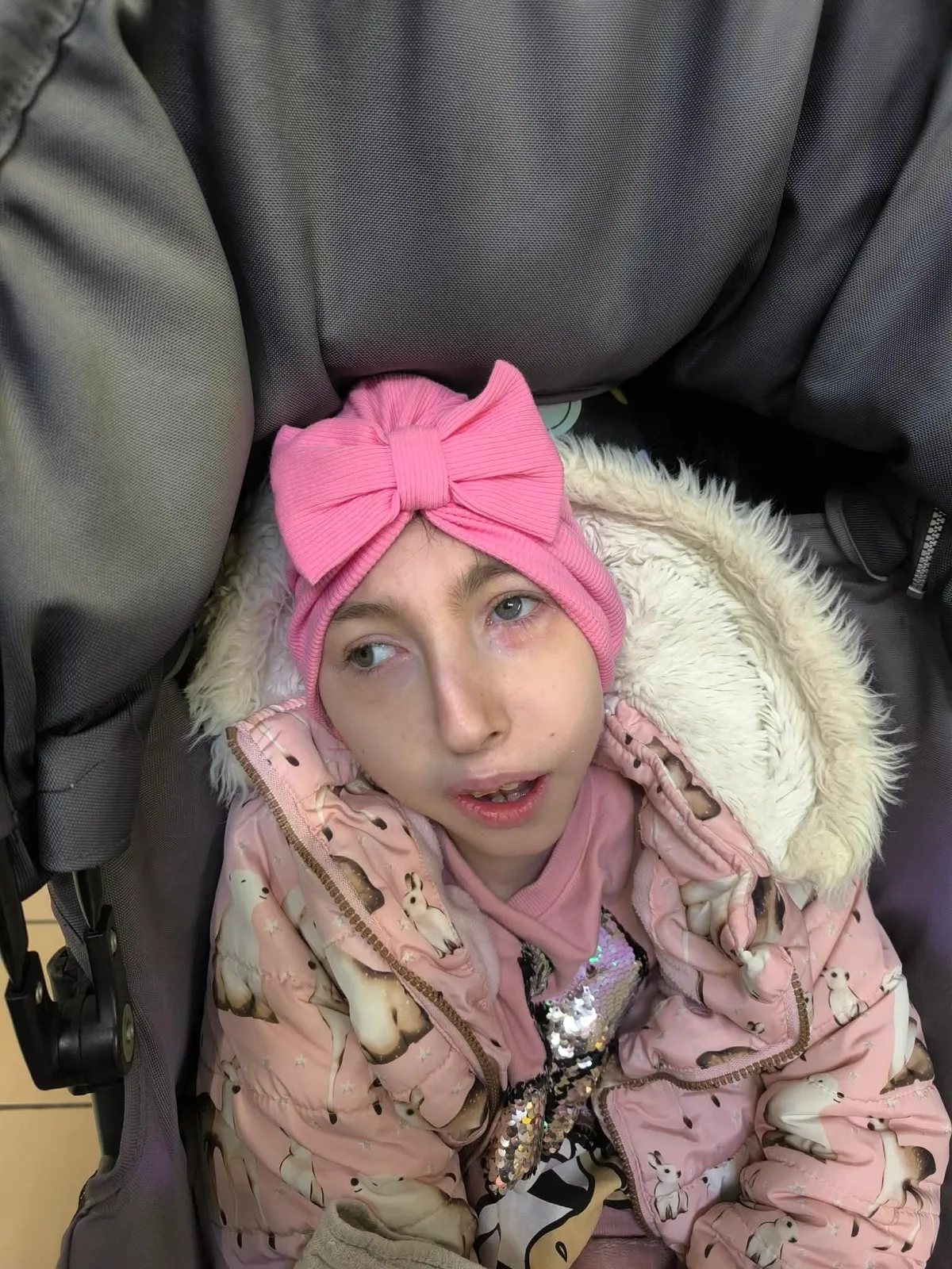 A diagnózis kegyetlen: a gerincdeformitás olyan mértékű, hogy nyomja a kislány tüdejét, ami folyamatos gyulladásokhoz és nehézlégzéshez vezet