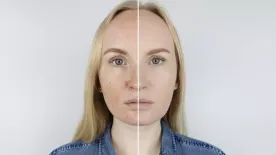 Ijesztő, mit művel a tavaszi nap a bőröddel – Így védekezz ellene