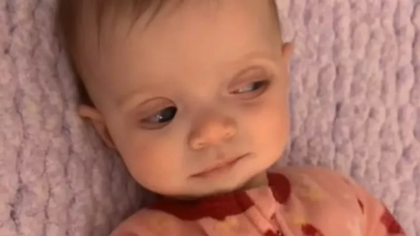 Boldog pillanatból rémálom: ritka szembetegséggel diagnosztizálták az újszülöttet