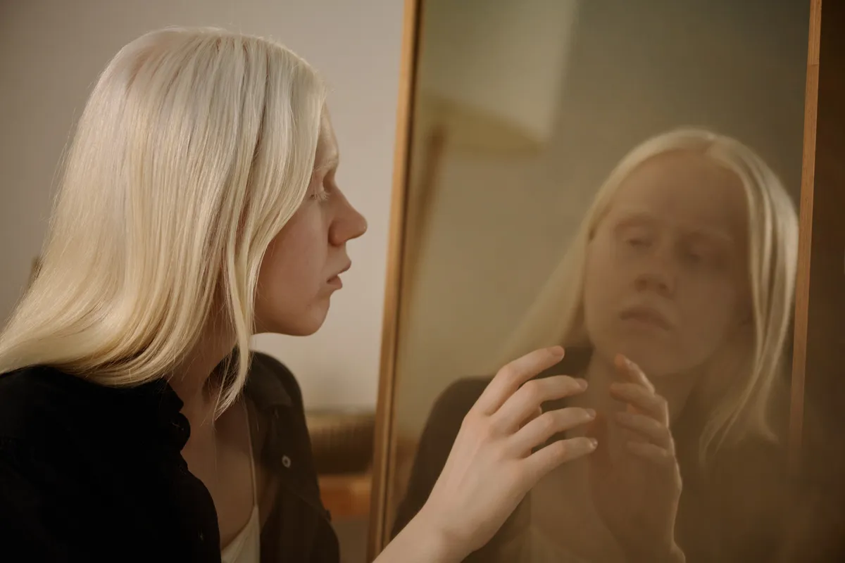 Albinizmussal élő fiatal nő egy tükör előtt