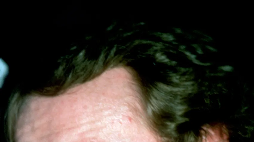 Kvíz kérdést ábrázoló kép