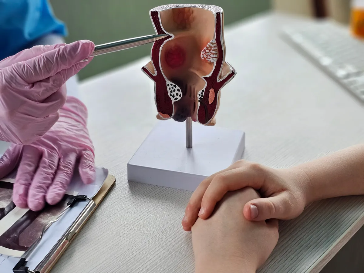 Aranyér bemutatása egy orvosi végbél maketten