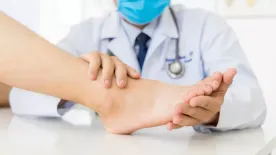 Bütyök nehezíti a járásod? Ekkor van szükség műtétre