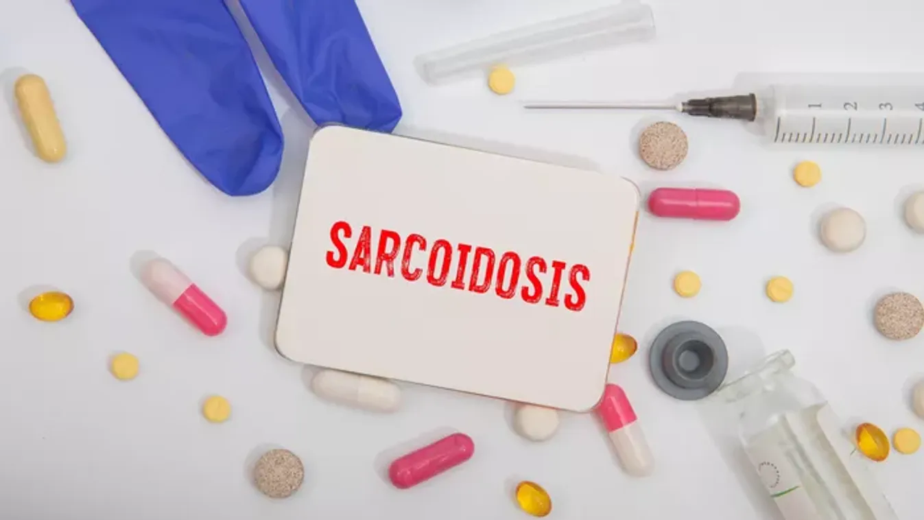 Mi az a szarkoidózis? – A ködös tüdő titka