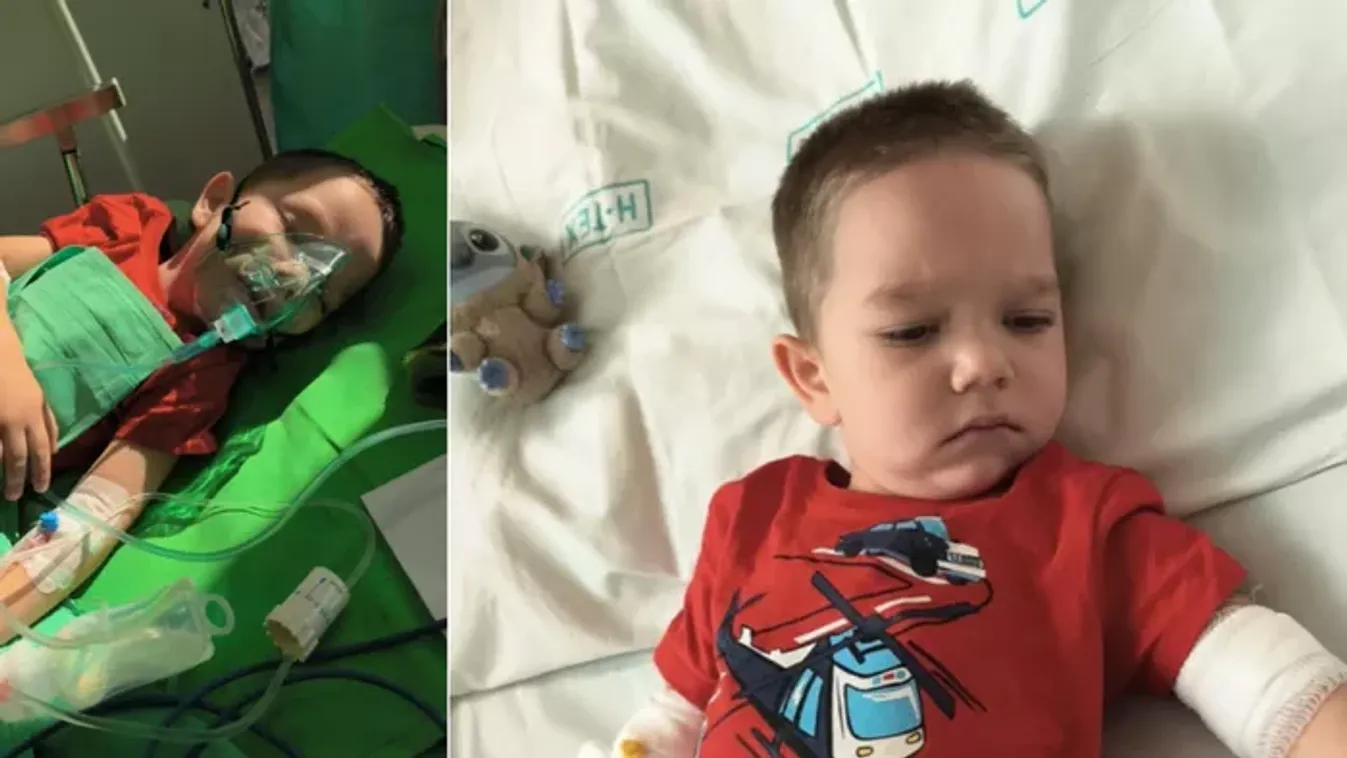 Sötét szobában szomorkodik a gipszbe zárt 3 éves kisfiú, Zentének csak egy vágya van