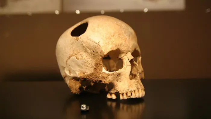 A sebészet története – Túlélhető brutalitás