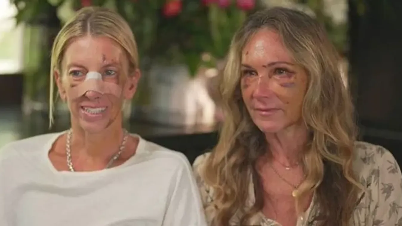 „Azt hittem, meg fogok halni” – bedrogozott sztárfogorvos támadt rá két nőre, a rendőrök végeztek vele