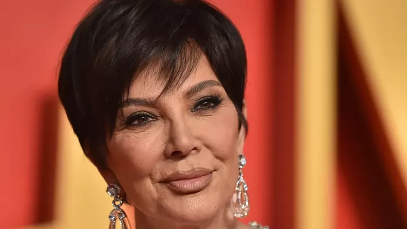 Kris Jenner őrjöng: nem elégedett a 100 ezer dolláros arcplasztikájával