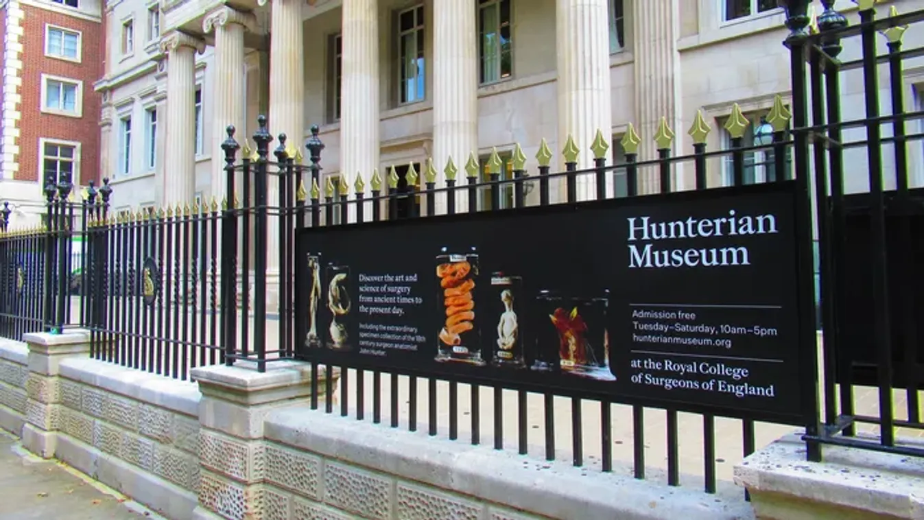 Különleges múzeumok: ezek a világ leghátborzongatóbb anatómiai kiállításai