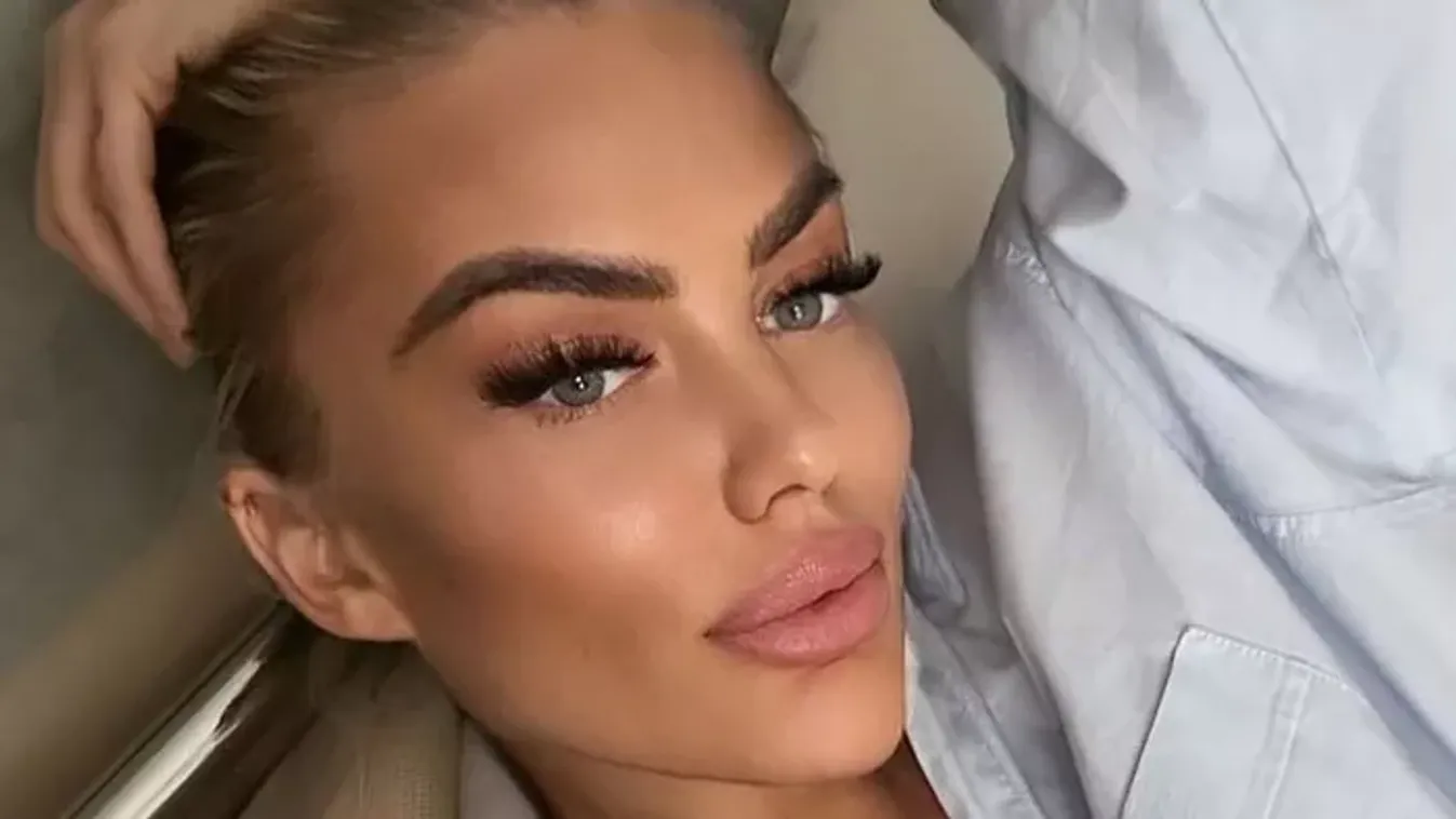 Kés alá feküdt Géczi Bea, sokkoló műtétjéről vallott: „Már zavart, hogy ilyen nagy...”