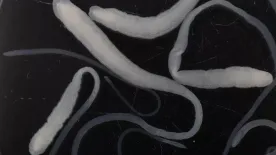 9 méteres szörnyeteg is lakhat a hasadban: ez a galandférgesség 5 leggyakoribb figyelmeztető jele